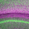A colorful image of brain cells.
