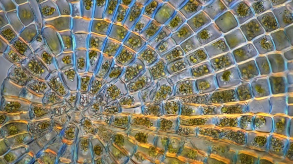 Polarised light micrograph of a Coleochaete sp. green algae colony. Coleochaete algae forms flat, sprawling discs on solid surfaces such as plants or debris in freshwater streams.