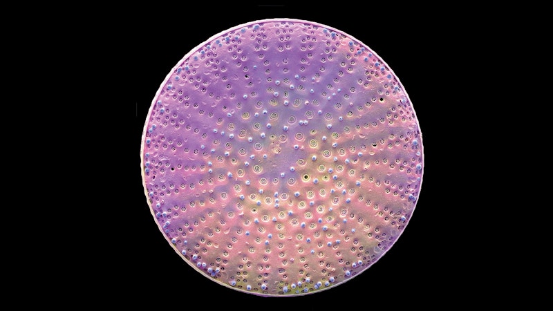 Detailed Diatom